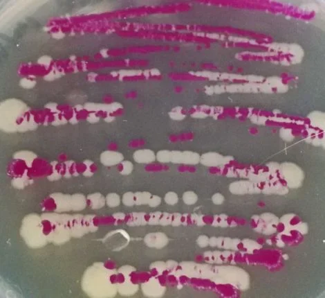 space bacteria (1) A microscopic close-up of bacteria cells